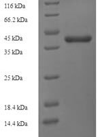 Salmonella typhi 3-dehydroquinate dehydratase (aroD) Recombinant Protein - BioCrest Sci