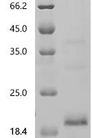 Human Ly-6/neurotoxin-like protein 1 (LYNX1) Recombinant Protein, C-His, Isoform 2, Mature - BioCrest Sci