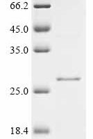Candida albicans Cell surface mannoprotein MP65 (MP65), partial Recombinant Protein, N-His-KSI - BioCrest Sci