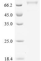 Human Desmoglein-1 (DSG1), partial Recombinant Protein, C-10His, aa 50–548 - BioCrest Sci