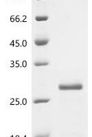 Bacteriophage H30 Shiga-like toxin 1 subunit B (stxB) Recombinant Protein, N-His-SUMOstar - BioCrest Sci