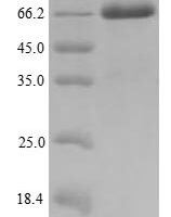 Human Melanoma-associated antigen 10 (MAGEA10) Recombinant Protein - BioCrest Sci