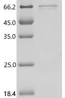 Autographa californica nuclear polyhedrosis virus Major envelope glycoprotein (GP64),partial Recombinant Protein - BioCrest Sci