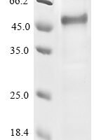 Human Beta-2-glycoprotein 1 (APOH), partial Recombinant Protein - BioCrest Sci