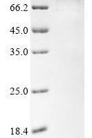 Angiostrongylus cantonensis Galectin Recombinant Protein - BioCrest Sci