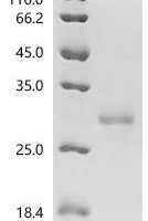 Horse Prolactin (PRL) Recombinant Protein, C-His - BioCrest Sci