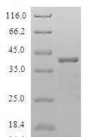 Human Uncharacterized protein C8orf4 (C8orf4) Recombinant Protein - BioCrest Sci