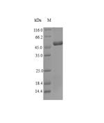 Dermatophagoides farinae Tropomyosin Recombinant Protein, Dermatophagoides farinae (American house dust mite), E.coli, N-terminal 6xHis-SUMO-tagged, 49.0 kDa, purity >≥ 90% as determined by SDS-PAGE.