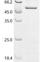 Human Egl nine homolog 1 (EGLN1) Recombinant Protein, N-10His - BioCrest Sci