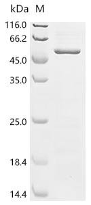 Human Egl nine homolog 1 (EGLN1) Recombinant Protein, N-10His, Homo sapiens (Human), E.coli, N-terminal 10xHis-tagged, 49.7 kDa, purity >≥ 85% as determined by SDS-PAGE.