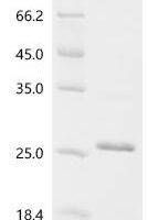 Human Astrotactin-1 (ASTN1), partial Recombinant Protein - BioCrest Sci