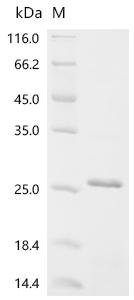 Human Astrotactin-1 (ASTN1), partial Recombinant Protein, Homo sapiens (Human), E.coli, C-terminal 6xHis-tagged, 21.8 kDa, purity >≥ 85% as determined by SDS-PAGE.
