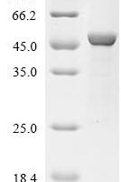 Human Acetyl-CoA acetyltransferase, mitochondrial (ACAT1) Recombinant Protein, N-Flag - BioCrest Sci