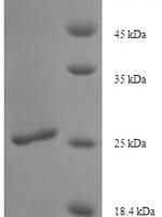 Gardnerella vaginalis 5-1 Site-specific DNA-methyltransferase (adenine-specific) Recombinant Protein - BioCrest Sci