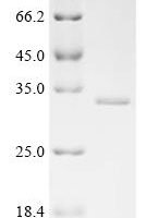 Human Putative uncharacterized protein C11orf40 (C11orf40) Recombinant Protein - BioCrest Sci