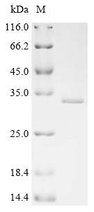Human Putative uncharacterized protein C11orf40 (C11orf40) Recombinant Protein, Homo sapiens (Human), E.coli, C-terminal 6xHis-tagged, 32.4 kDa, purity >≥ 90% as determined by SDS-PAGE.