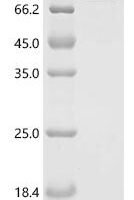 Human ATP-dependent RNA helicase DDX3X (DDX3X) Recombinant Protein, C-His - BioCrest Sci