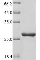 Human PRELI domain containing protein 3B (PRELID3B) Recombinant Protein - BioCrest Sci