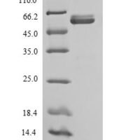Sheep Interleukin-12 subunit beta (IL12B) Recombinant Protein, N-His, aa 23–327, E.coli - BioCrest Sci