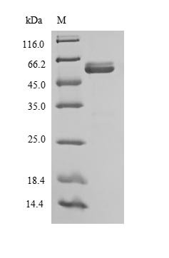 Sheep Interleukin-12 subunit beta (IL12B) Recombinant Protein, N-His, aa 23–327, E.coli, Ovis aries (Sheep), E.coli, N-terminal 6xHis-tagged, 38.5 kDa, purity >≥ 90% as determined by SDS-PAGE.