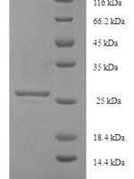 Human Uncharacterized protein KIAA1377 (KIAA1377), partial Recombinant Protein, N-His-SUMO, aa 559–670, Yeast - BioCrest Sci