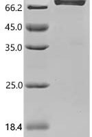 Rat Acyl-coenzyme A thioesterase 1 (Acot1) Recombinant Protein, N-hFc1/C-10His - BioCrest Sci