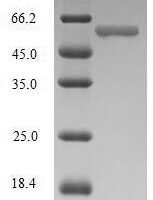 Human Immunoglobulin J chain (JCHAIN) Recombinant Protein, N-MBP/C-His - BioCrest Sci