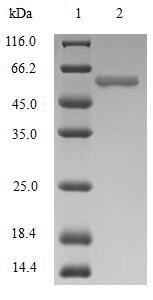 Human Immunoglobulin J chain (JCHAIN) Recombinant Protein, N-MBP/C-His, Homo sapiens (Human), Baculovirus, N-terminal MBP-tagged and C-terminal 6xHis-tagged, 59.6 kDa, purity >≥ 85% as determined by SDS-PAGE.