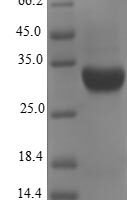 Escherichia coli K99 fimbrial protein (fanC) Recombinant Protein - BioCrest Sci