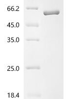 Human Sushi repeat-containing protein SRPX2 (SRPX2) Recombinant Protein - BioCrest Sci