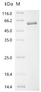 Human Sushi repeat-containing protein SRPX2 (SRPX2) Recombinant Protein, Homo sapiens (Human), E.coli, C-terminal 6xHis-tagged, 57.4 kDa, purity >≥ 85% as determined by SDS-PAGE.