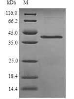 Schizosaccharomyces pombe NADH kinase pos5, mitochondrial (pos5) Recombinant Protein, N-His - BioCrest Sci