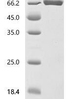Mouse Periostin (Postn), partial Recombinant Protein - BioCrest Sci