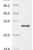 Cowpea chlorotic mottle virus Capsid protein (ORF3b) Recombinant Protein - BioCrest Sci