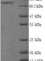 Human CD44 antigen (CD44), partial Recombinant Protein, N-His-SUMO, aa 21–606 - BioCrest Sci