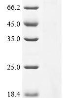 Mouse Dapper homolog 1 (Dact1) Recombinant Protein - BioCrest Sci