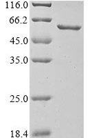 Human G2/mitotic-specific cyclin-B1 (CCNB1) Recombinant Protein, N-10His/C-Myc, aa 1–433, E.coli - BioCrest Sci