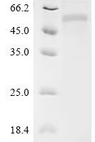 Human Butyrophilin-like protein 2 (BTNL2), partial Recombinant Protein, C-10His - BioCrest Sci