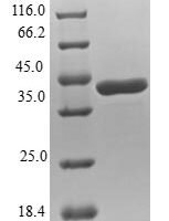 Human Bis (5'-nucleosyl)-tetraphosphatase [asymmetrical] (NUDT2) Recombinant Protein - BioCrest Sci