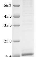 Pongo abelii Transmembrane protein 168 (TMEM168), partial Recombinant Protein, N-10His/C-Myc, aa 527–637, Baculovirus - BioCrest Sci