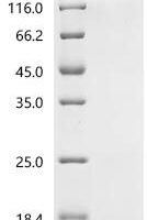 Human Transmembrane protein 106B (TMEM106B), partial Recombinant Protein - BioCrest Sci