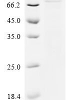 Human Origin recognition complex subunit 1 (ORC1), partial Recombinant Protein, C-10His, aa 201–782 - BioCrest Sci