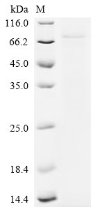 Human Origin recognition complex subunit 1 (ORC1), partial Recombinant Protein, C-10His, aa 201–782, Homo sapiens (Human), Baculovirus, C-terminal 10xHis-tagged, 70.9 kDa, purity >≥ 85% as determined by SDS-PAGE.