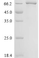 Human Phosphoglucomutase (PGM2) Recombinant Protein, C-His, aa 2–612, Mammalian cell - BioCrest Sci