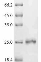 Human Protein max (MAX) Recombinant Protein - BioCrest Sci