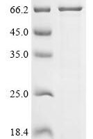 Human Galactocerebrosidase (GALC) Recombinant Protein, Tag-Free - BioCrest Sci