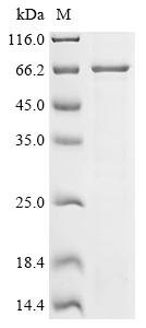 Human Galactocerebrosidase (GALC) Recombinant Protein, Tag-Free, Homo sapiens (Human), in vitro E.coli expression system, Tag-Free, 73.0 kDa, purity >≥ 85% as determined by SDS-PAGE.