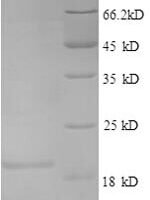 Human Interleukin-4 (IL4) Recombinant Protein - BioCrest Sci