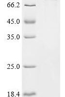 Escherichia coli Ferrienterobactin receptor (fepA) Recombinant Protein - BioCrest Sci