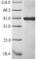 Human herpesvirus 1 Envelope glycoprotein L (gL) Recombinant Protein - BioCrest Sci